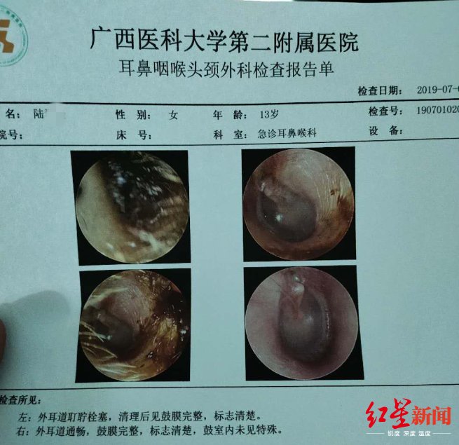 8女生围殴1女生 打人仅仅因“看不顺眼”